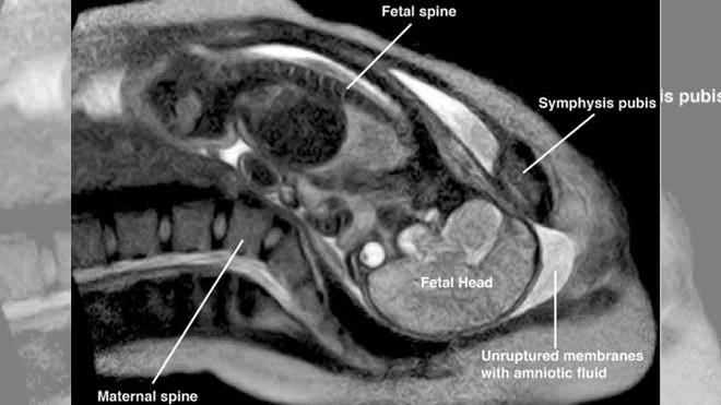 MRI Baby.jpg